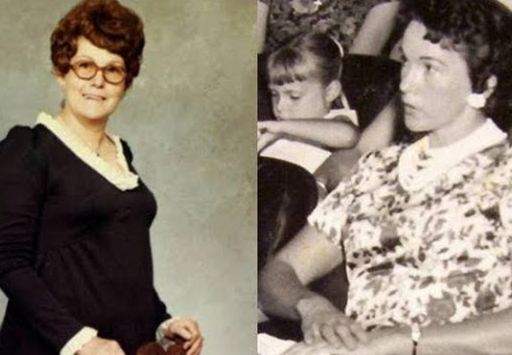 Timi Džin Lindzi prva žena koja je ugradila silikonske grudi! (VIDEO)