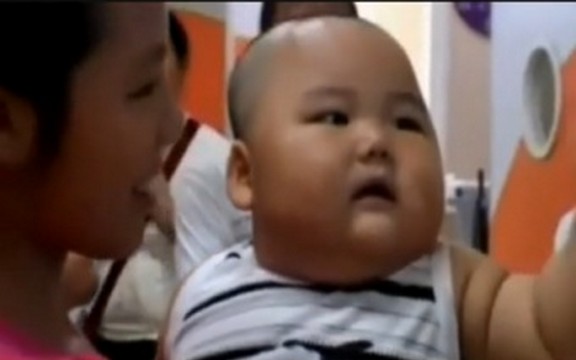 Kina: Desetomesečna beba teška 20 kg