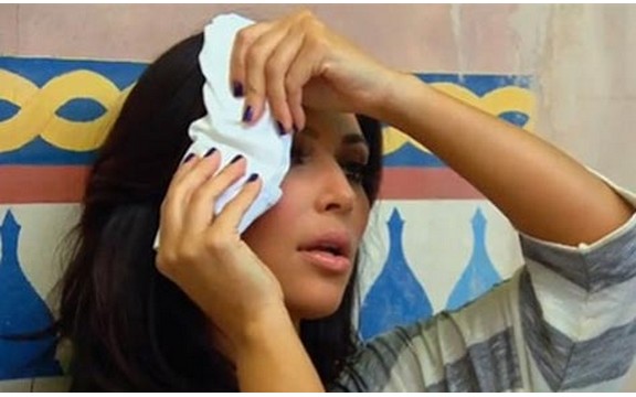 Kim Kardashian ubrizgala botox pred kamerama (Video)
