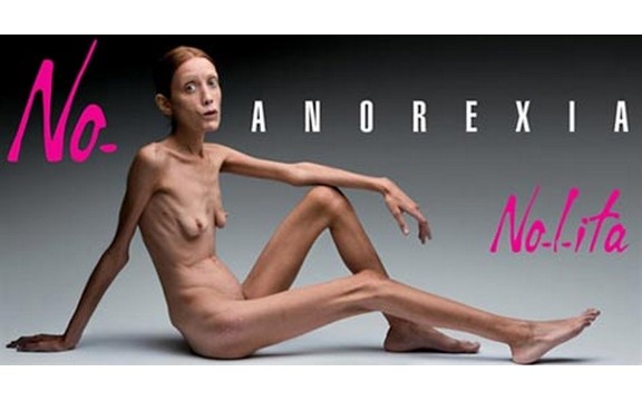 Preminula ambasadorka anoreksije