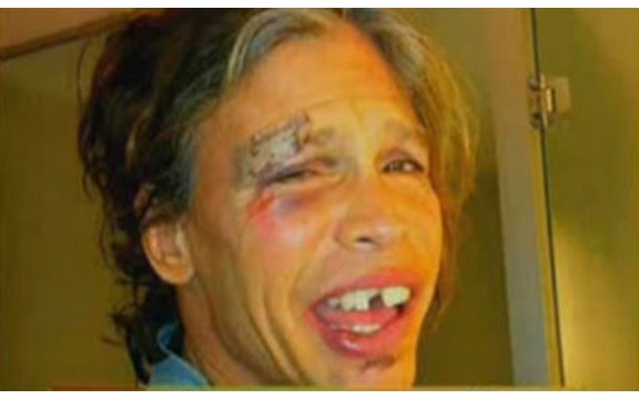 Pogledajte kako izgleda Stiven Tajler nakon pada i sa polomljenim zubima (Video)