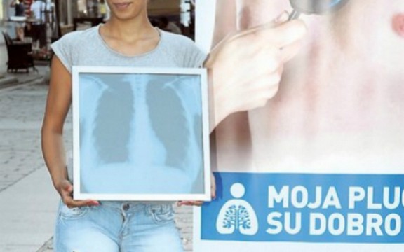 Milica Majstorović protiv raka pluća (Foto)