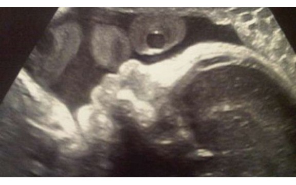 Pogledajte ultrazvuk Šakirine bebe  (Foto)