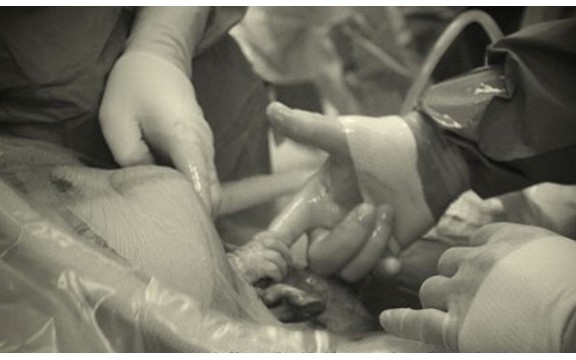 Hit na Internetu: Nerođena beba uhvatila doktora za prst