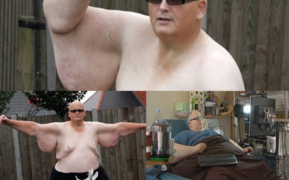 Paul Mason, najdeblji čovek na svetu, smršao 300 kilograma!