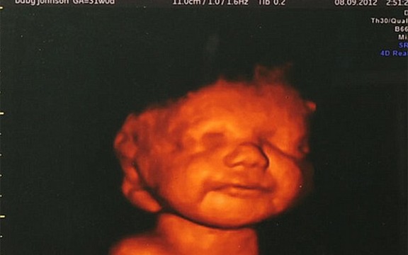 Dirljivo: Hrabra majka odustala od abortusa kada je ugledala bebin osmeh 