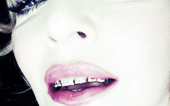 Madona pokazala zlatne zube! (Foto)