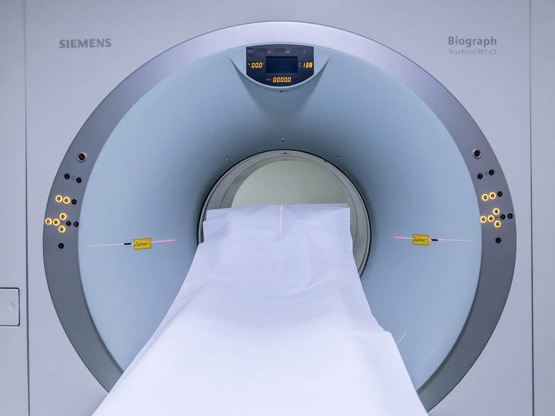 Bizarna smrt u bolnici: Čoveka ubila magnetna rezonanca!
