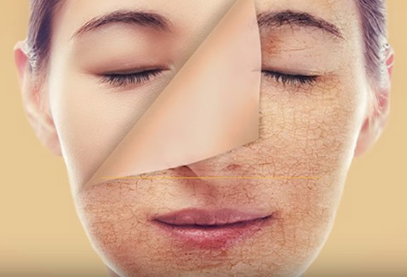 Najnoviji TikTok video otkriva makeup koji uzrokuje akne: Evo šta treba ..